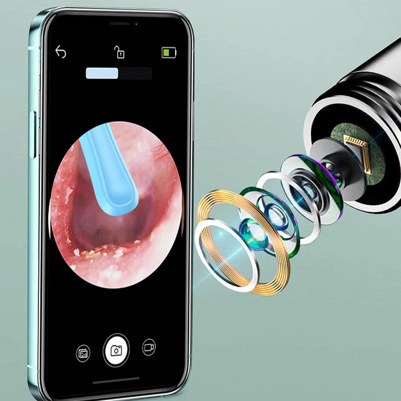 Solvera EarPro™ - Voor visuele oorreiniging, zie precies wat je schoonmaakt.